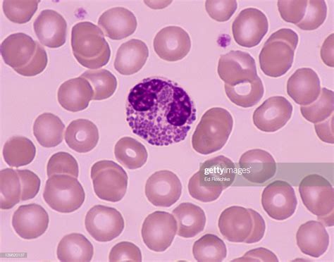 Eosinophil White Blood Cell Occur In Allergies 13 Of The
