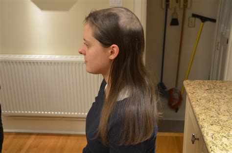I know it sounds silly but i have a friend who's cat pulled the fur off his tail until part of it was bald.and it was because of their new puppy. I Shaved My Head to Stop Pulling Out My Hair