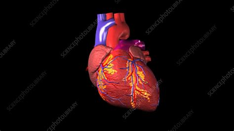 Enlarged Heart Stock Video Clip K0033655 Science Photo Library