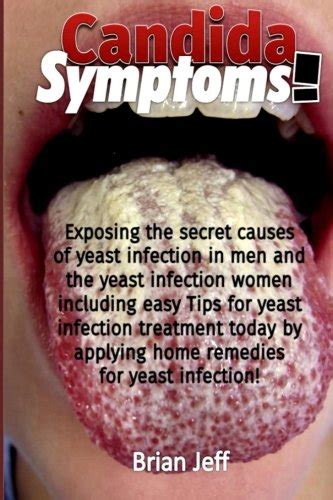 Coche Stevenson Vesícula Biliar Male Candida Symptoms Acumulación