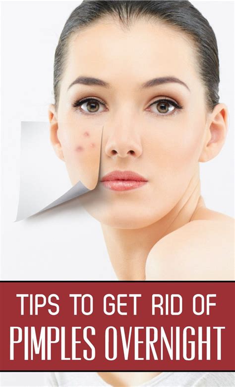 6 Ways To Get Rid Of A Pimple Naturally Healthandrecipe