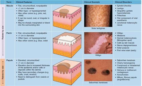 introduction to dermatology the basics describing skin lesions sexiezpicz web porn
