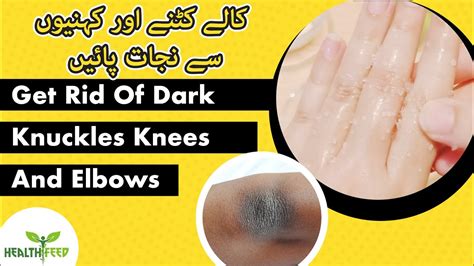Get Rid Of Dark Knuckles Knees And Elbows 3 Simple Steps Health