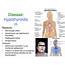 PPT  Disease Hypothyroidism PowerPoint Presentation Free Download