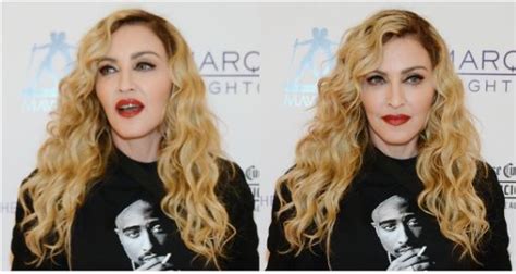 Madonna Shows Off The Scars She Got From Her Hip Surgery Fakaza News
