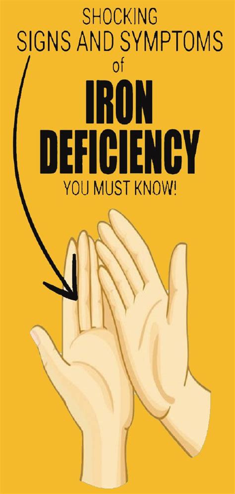 13 Signs And Symptoms That You Have An Iron Deficiency Healthy Lifestyle