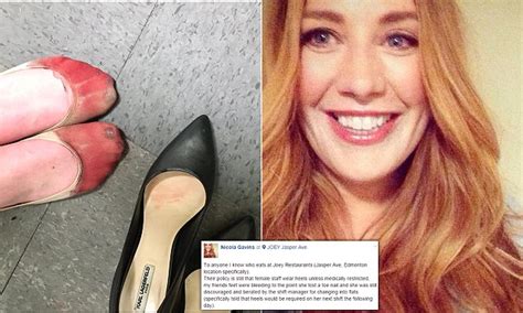 Canada Waitress Shares Bleeding Feet On Facebook After Working 8 Hour Shift In Heels Daily