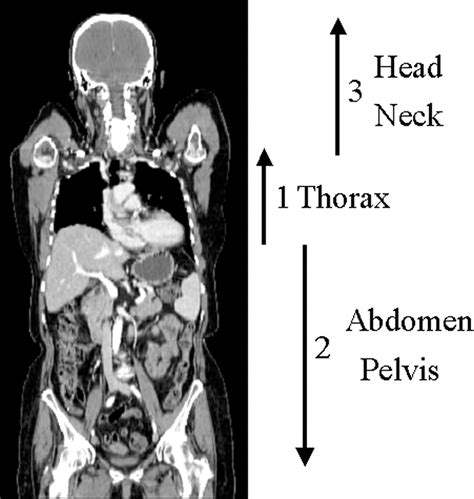 Abdominal Pelvic Ct Scan With Contrast Ct Scan Machine