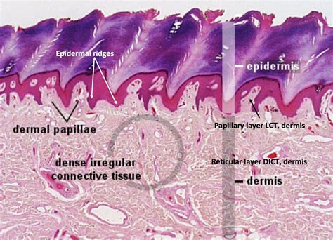 Thick Skin Histology Histology Slides Nursing Tips Thick Skin