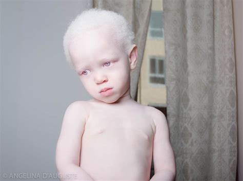 Unique Beauty Of Albino People Demilked