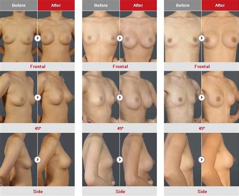 Size A Tits Nude - Breast Sizes Nude | Sex Pictures Pass