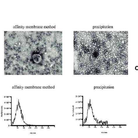 Characterization Of Exosomes Extracted Using Three Exosome Extraction