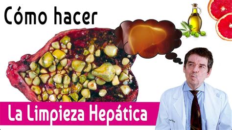 C Mo Hacer La Limpieza Hep Tica Depura Tu Cuerpo Paso A Paso