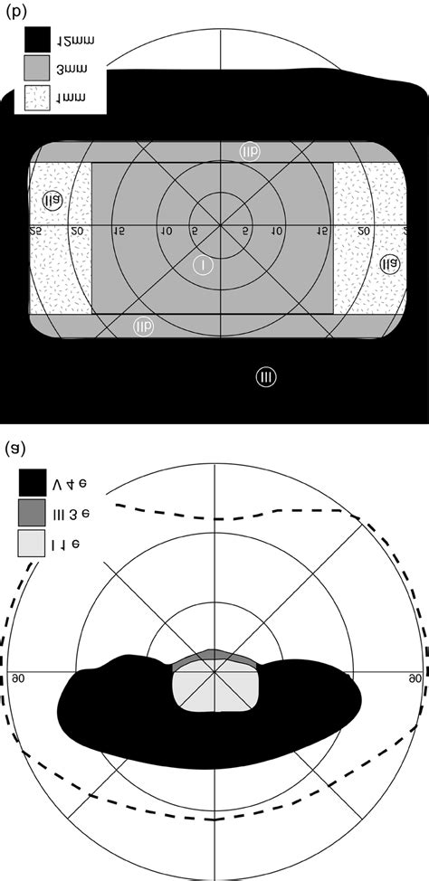 Binocular Visual Field With A Sony Glasstron Plm 50 A Measured With