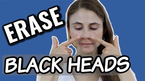 Erase Blackheads Dermatologist Tips Dr Dray Youtube