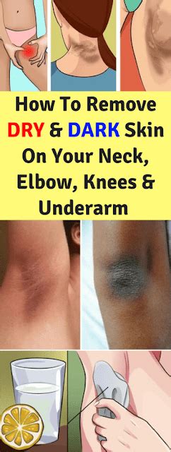 How To Remove Dry And Dark Skin On Your Neck Elbows Knees And Underarms