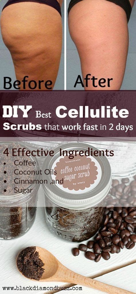 Diy Best Cellulite Scrubs That Work Fast In 2 Days With Most Powerful