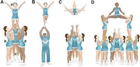Understanding The Cheerleader As An Orthopaedic Patient An Evidence