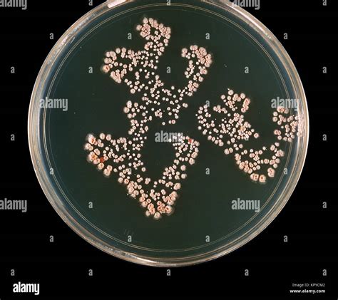 This Is A Plate Culture Of The Bacteria Nocardia Asteroides Grown On