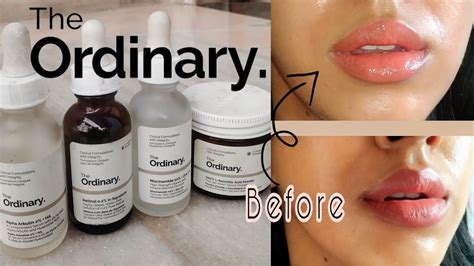 The Ordinary Skincare For Hyperpigmentation Uneven Skintone Best