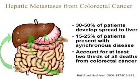 Colorectal Liver Metastases With Extrahepatic Disease Surgical Outcomes Perry Shen Md