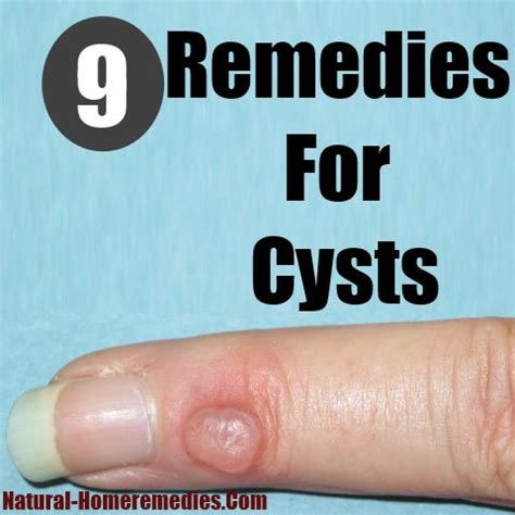 There are a number of things. healthoverflowing.com | Health Cysts Cures3Herbal ...