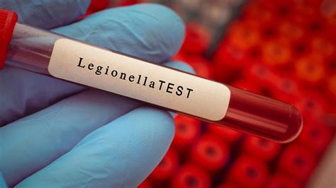 Legionella Water Temperature All Your Questions Answered Learn How