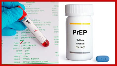 best practices of same day hiv pre exposure prophylaxis prep initiation the ontario hiv