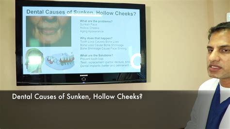 It is impossible to determine which one is true, but in either case, the vaccine was the proximal cause of his death. What are the Causes of Hollow, Sunken Cheeks? Tooth Loss ...