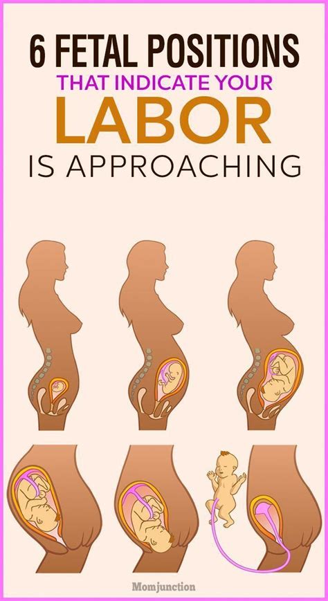 Fetal Positions That Indicate Your Labor Is Approaching Fetal