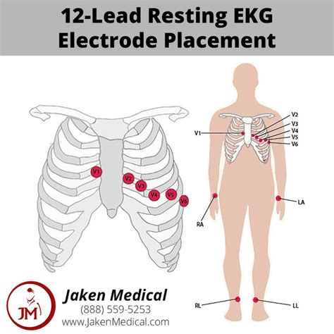 12 Lead Resting Ekg Electrode Placement Ekg Leads Ekg Placement Ekg