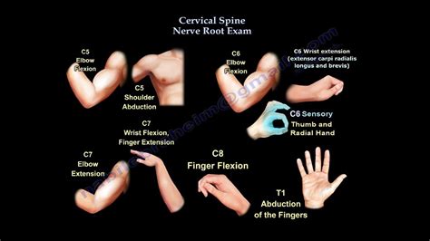 Cervical Spine Nerve Root Exam Everything You Need To Know Dr