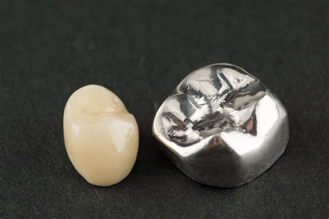 What Is The Best Dental Crown Material