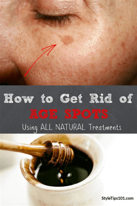 How To Get Rid Of Age Spots Healthy News