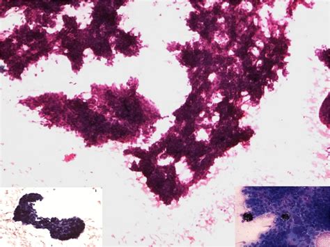 Cellular Smear Showing Cohesive Clusters Of Cells With Sharp Outlines