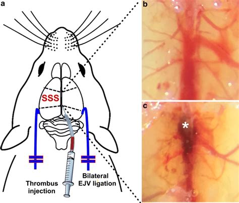 Mouse Model Of Cerebral Sinus Venous Thrombosis CVST A Schematic Download Scientific Diagram