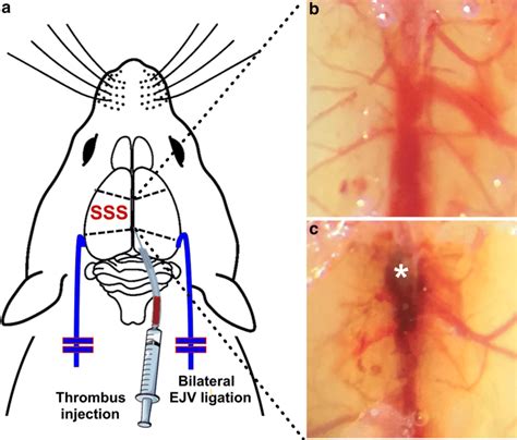 Mouse Model Of Cerebral Sinus Venous Thrombosis Cvst A Schematic Download Scientific Diagram