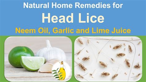 Natural Home Remedies For Head Lice Get Rid Head Lice With Neem Oil