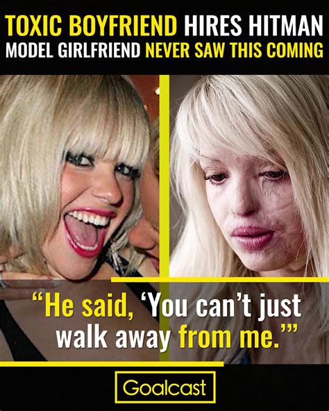 Katie Piper Toxic Boyfriend Hires Hit Man Model Girlfriend Never Saw This Coming Model