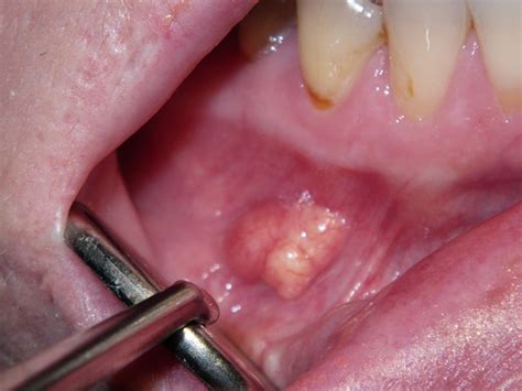 Com July 2011 Diagnosis Uw School Of Dentistry