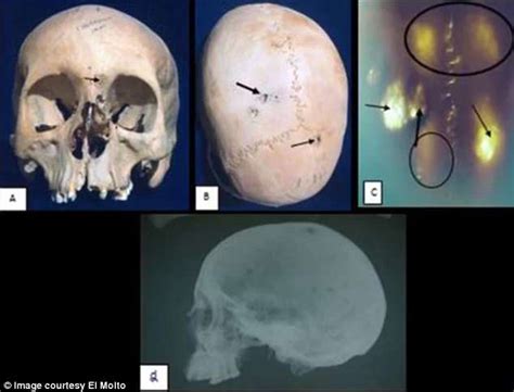 Ancient Egyptian Skeletons With Signs Of Cancer Found Daily Mail Online