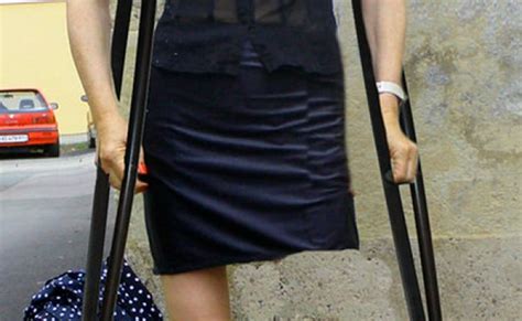 Flickr Amputee Woman Crutches Images Otosection