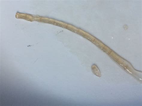 Tapeworms are flat worms that are segmented. Worm... or... at Parasites Support Forum (Alt Med), topic ...