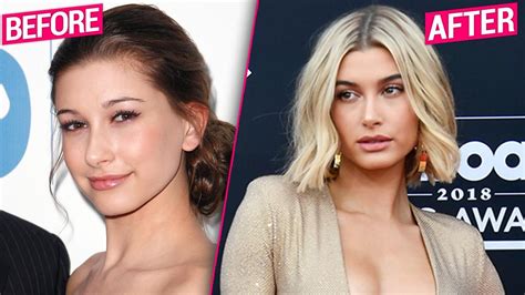 hailey baldwin s plastic surgery revealed by top doctors