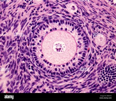 Micrografía De Microscopio De Luz De Un Ovario Folículo Primario Con Un Ovocito Redondo Grande