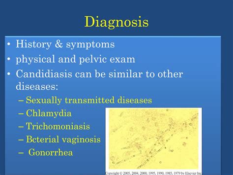 ppt candida infection t ricpmonas vaginalis bacterial vaginosis powerpoint presentation id