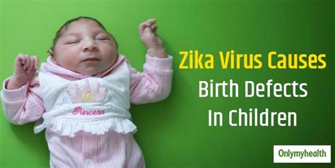 Can Zika Virus Transmit From Mother To Baby In The Womb This Study