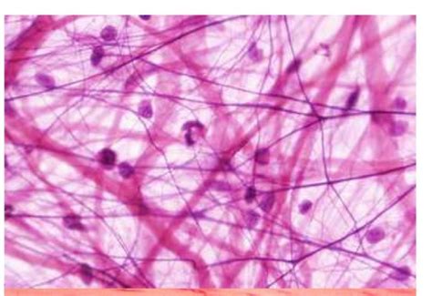 Areolar Connective Tissue Histology
