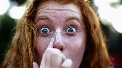 Hidden Red Head Gene May Put You At Greater Risk For Skin Cancer The