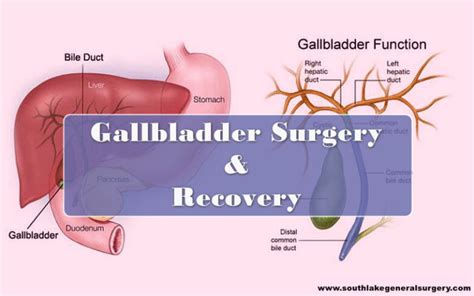 Gallbladder Removal Surgery Complications And Recovery